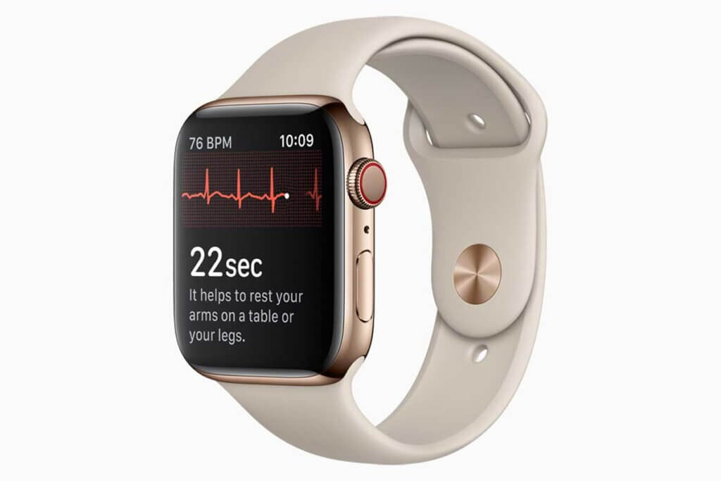 weiĂe Apple Watch