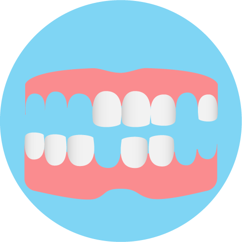 Teilprothese