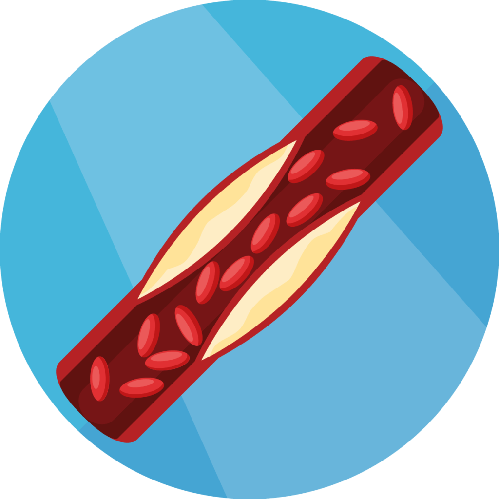 Arteriosklerose